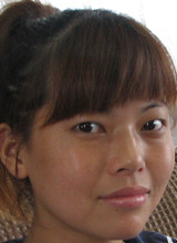 RUI